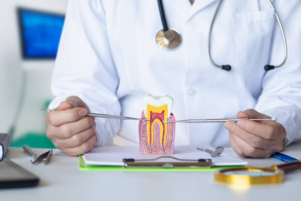Best Knocked-Out Tooth (Avulsed Tooth) Treatment in Wahneta, FL